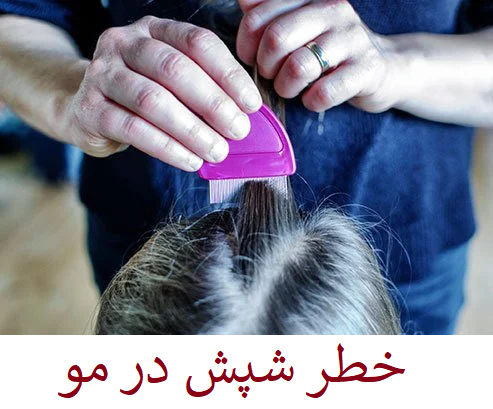 شپش | سیر تا پیاز درباره شپش و درمان شپش موی سر